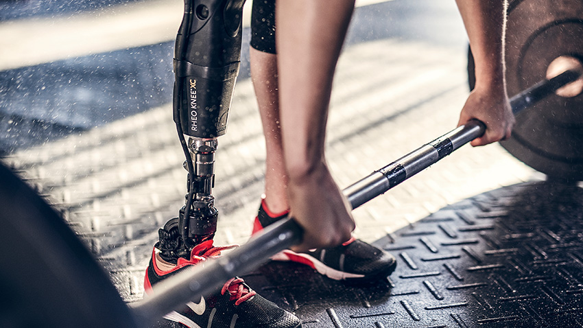 Achievements of prosthetics Achievements of prosthetics