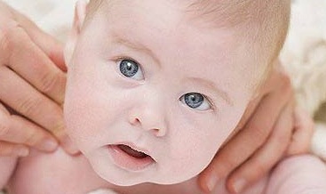 Torticollis