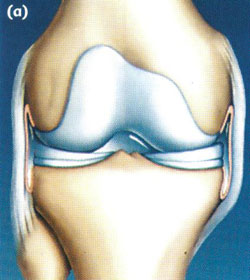 Arthroscopy of the knee joint3.jpg Arthroscopy of the knee joint3.jpg