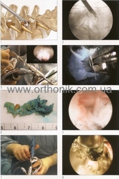 Foraminoscopy10.jpg Foraminoscopy10.jpg