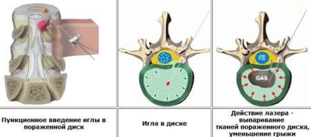 плазменное низкотемпертаруное выпариване диска.png