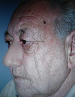 nose2.jpg nose2.jpg