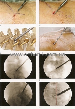 Этапы доступа.jpg