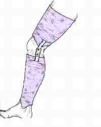 Orthoses3.jpg