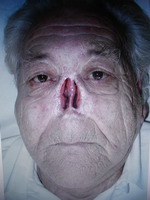 nose1.jpg nose1.jpg