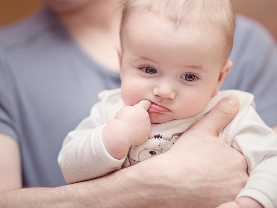 Torticollis Torticollis