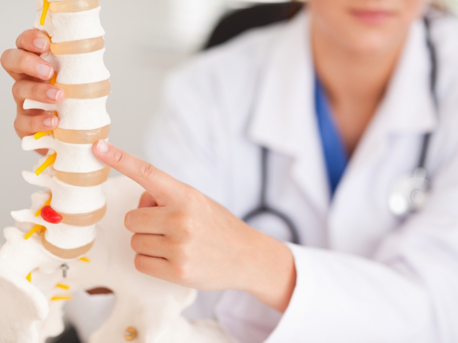 Кифопластика