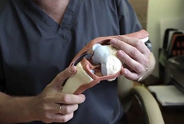 Schäden an den Bändern des Kniegelenks