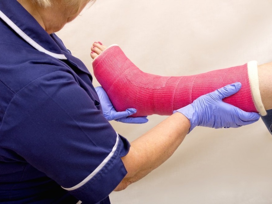 Gips der neuen Generation