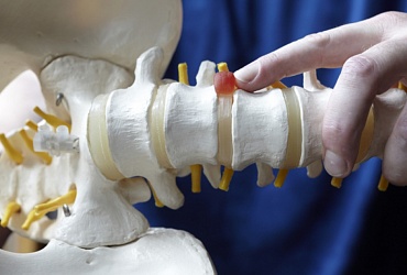 Plasma-Niedertemperatur-Verdampfung einer Scheibe