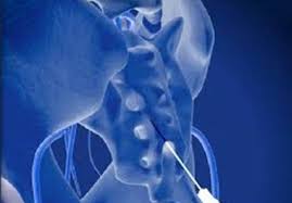 Сheminucleolysis Сheminucleolysis