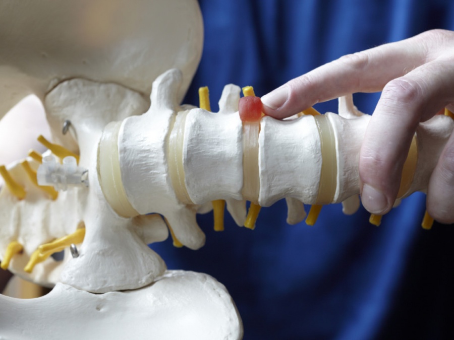 Spinal disease  Spinal disease