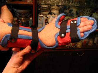 Пациент П.Т.К., 67 лет