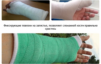 Гипс нового поколения