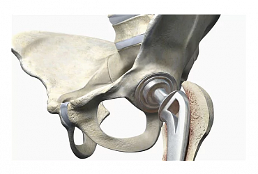 Artificial hip joint