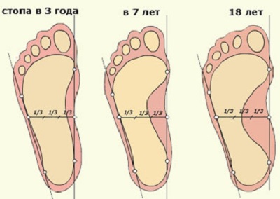 Flat foot Flat foot