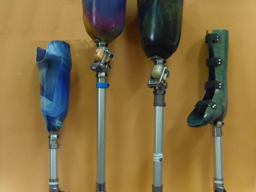 Prostheses of lower extremity Prostheses of lower extremity