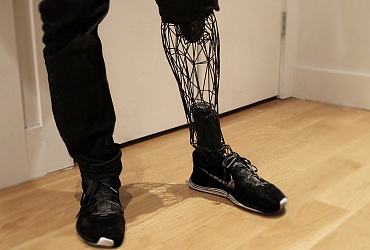 Пациент С.В.Г., 1960 г.р.