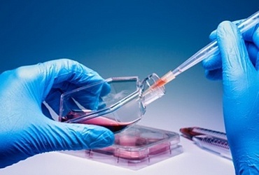 Behandlung mit Stammzellen