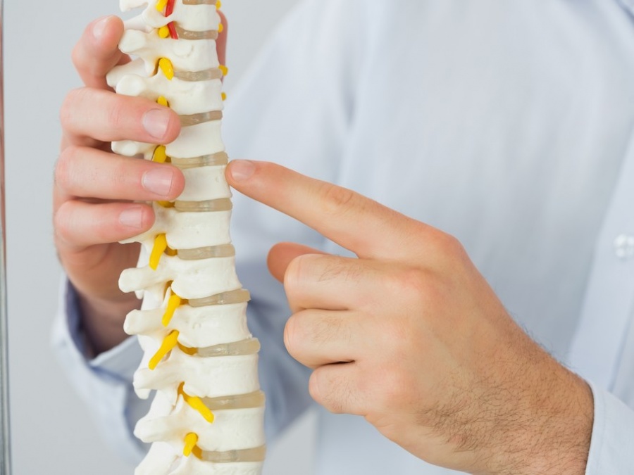 Scoliosis Scoliosis
